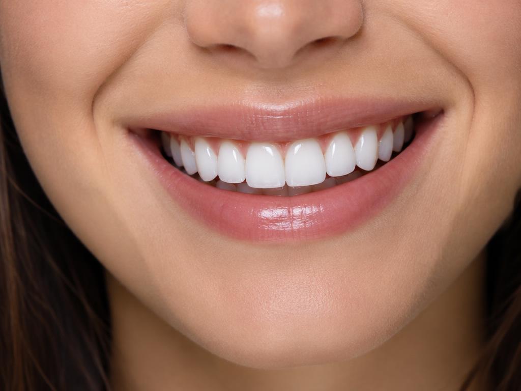 Porcelain veneers